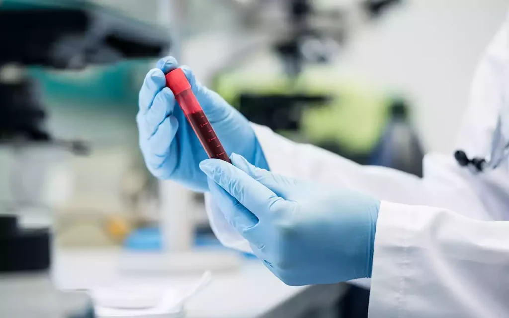blood test and pathalogy service in parkside health